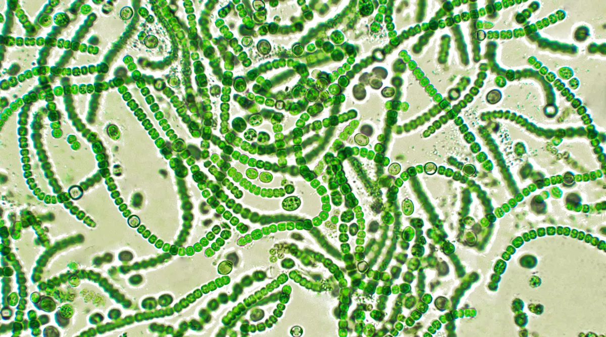 Cyanobakterien unter dem Mikroskop