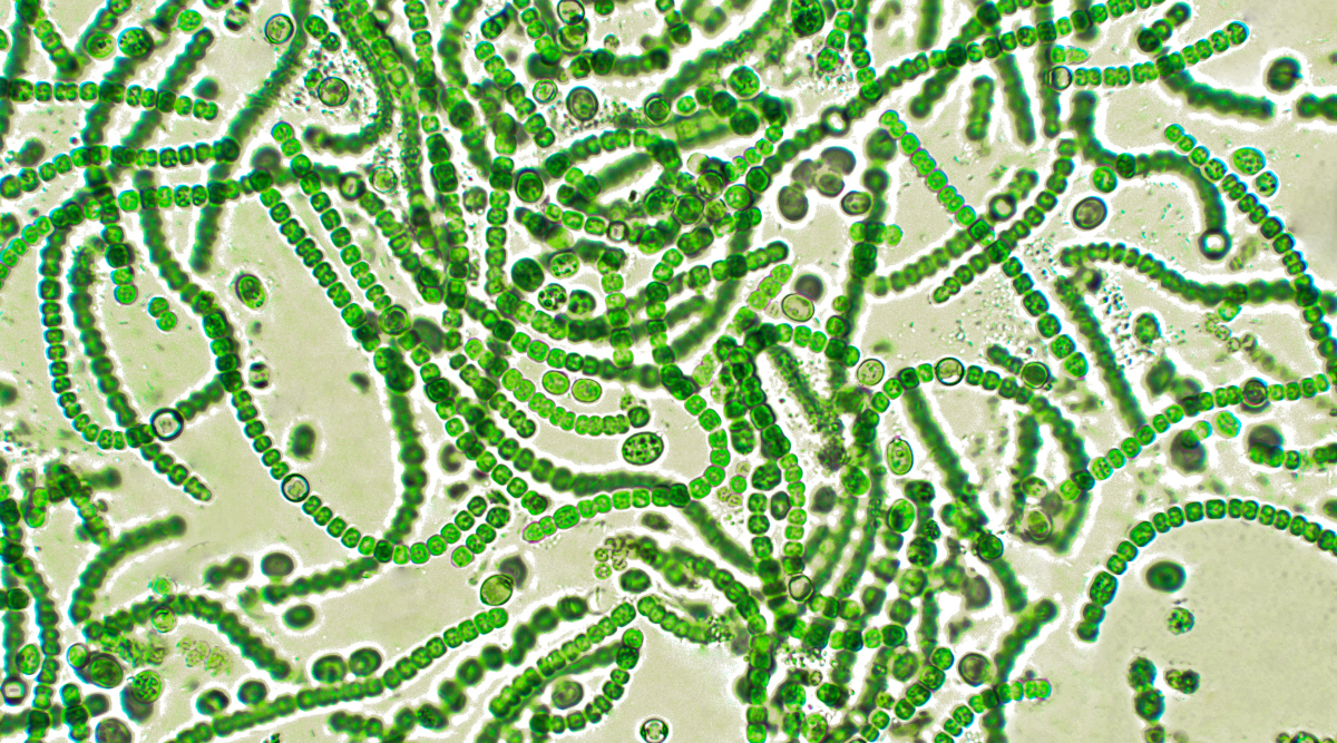 Cyanobakterien unter dem Mikroskop