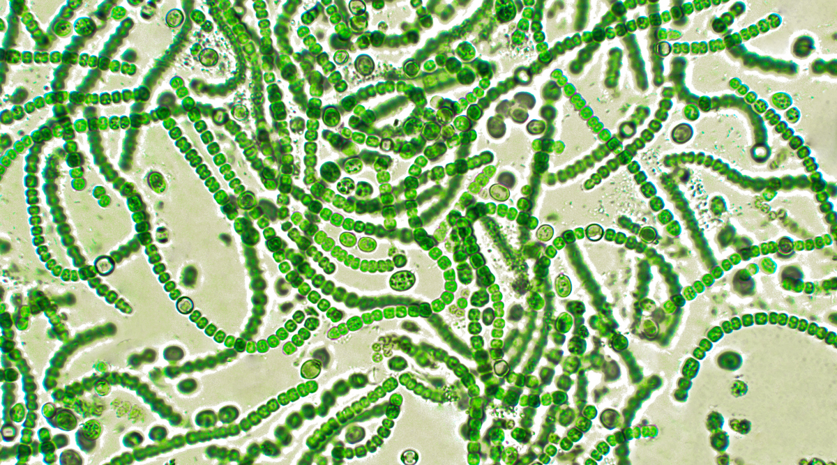 Cyanobakterien unter dem Mikroskop